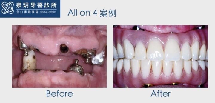 泉玥牙醫診所成功案例 1
