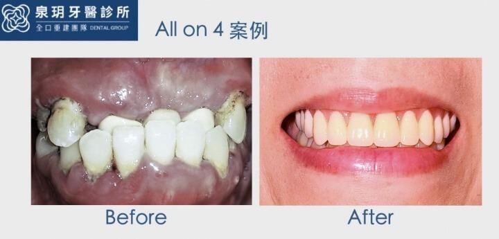 泉玥牙醫診所成功案例 2