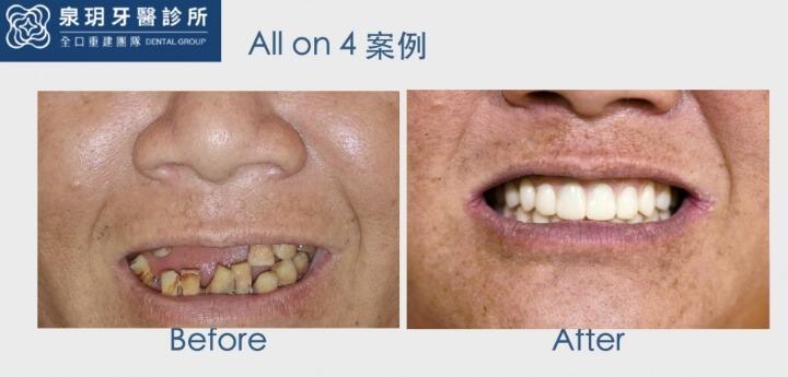 泉玥牙醫診所成功案例 3