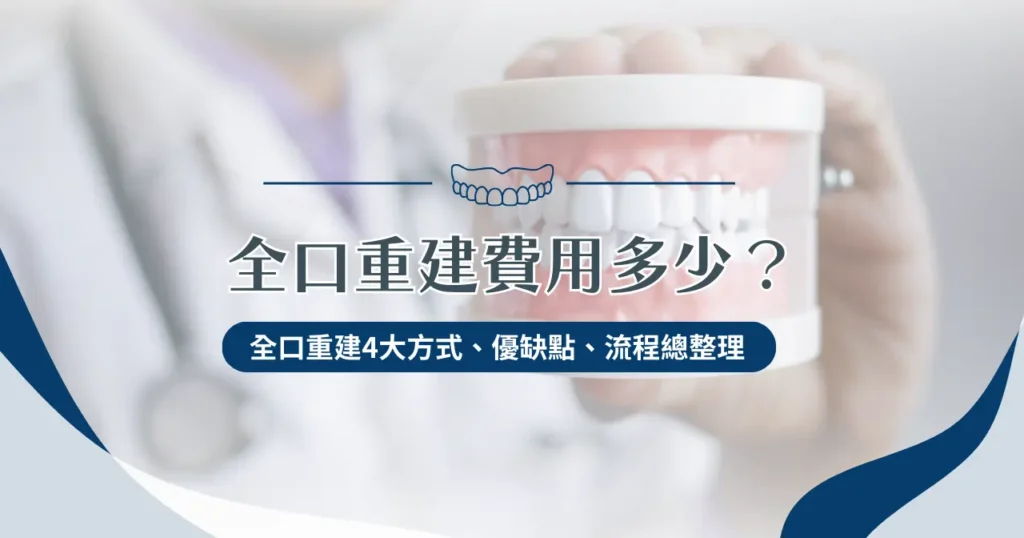 全口重建費用多少？全口重建 4 大方式、優缺點、流程總整理