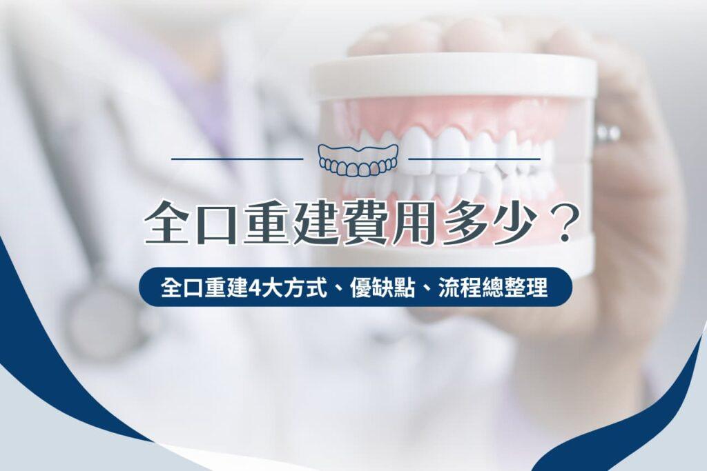 全口重建費用多少？全口重建 4 大方式、優缺點、流程總整理