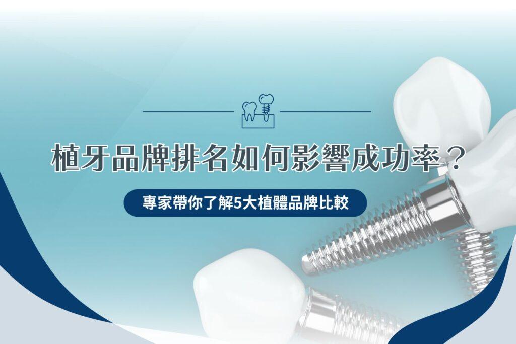 植牙品牌排名如何影響植牙成功率？ 5 大植體品牌深入比較