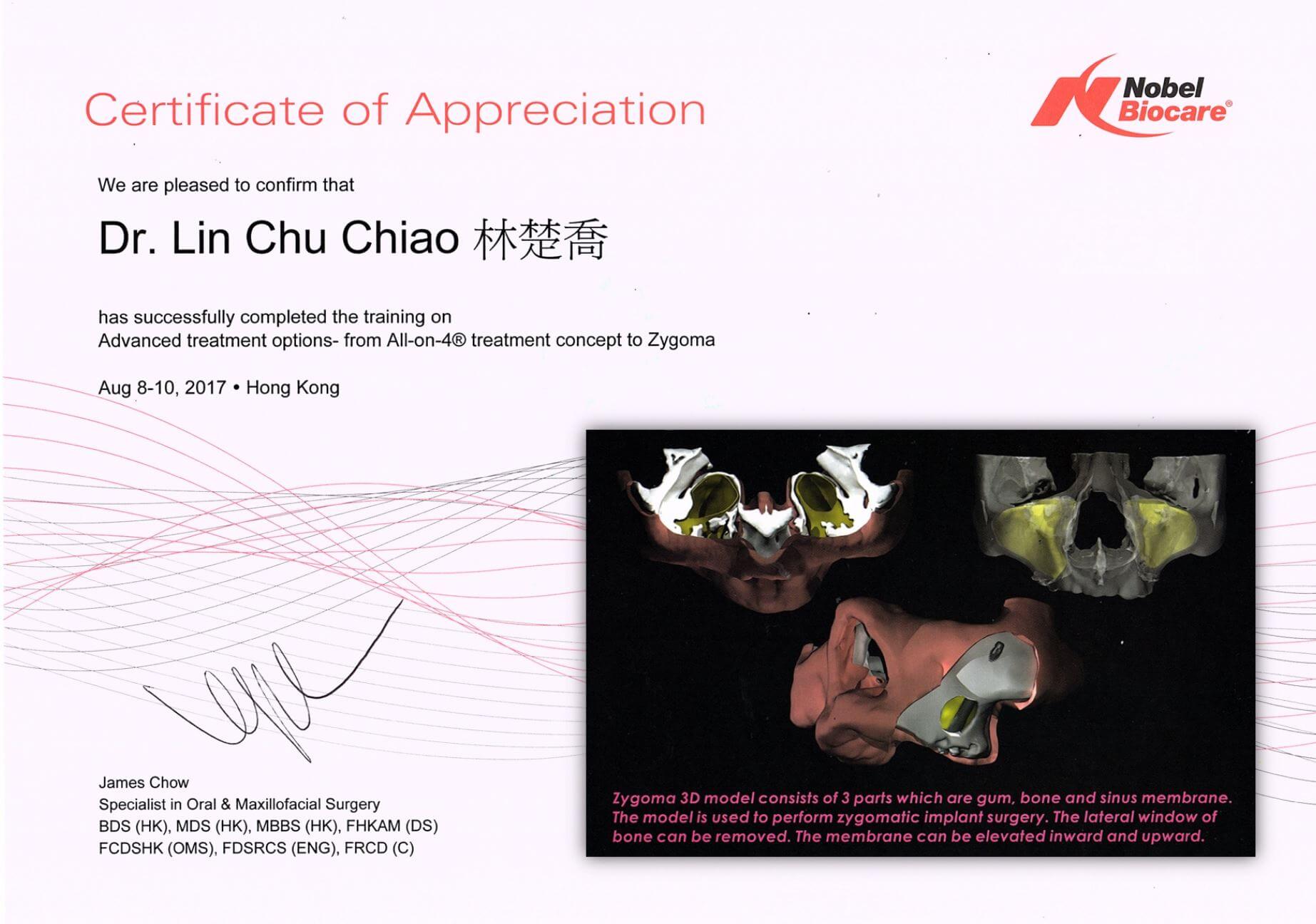 Nobel顴骨植牙專家認證