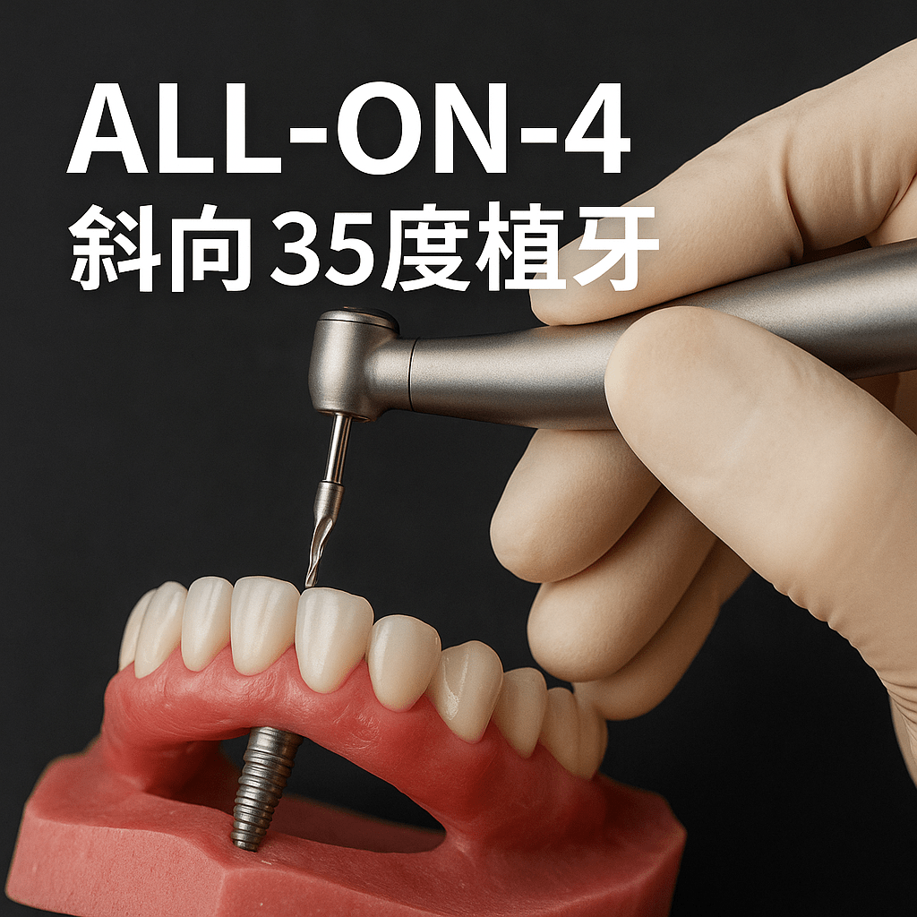 all on 4植牙