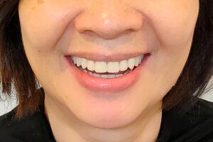 IMG20190817103030_01