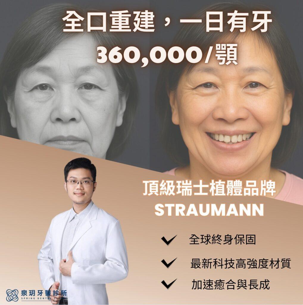 all on 4植牙36萬