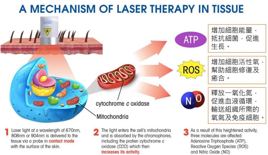 雷射幫助細胞癒合