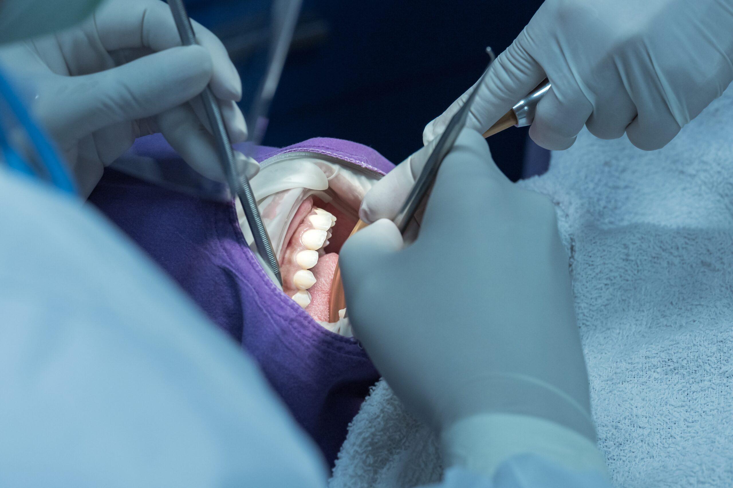 牙周病會傳染給別人嗎