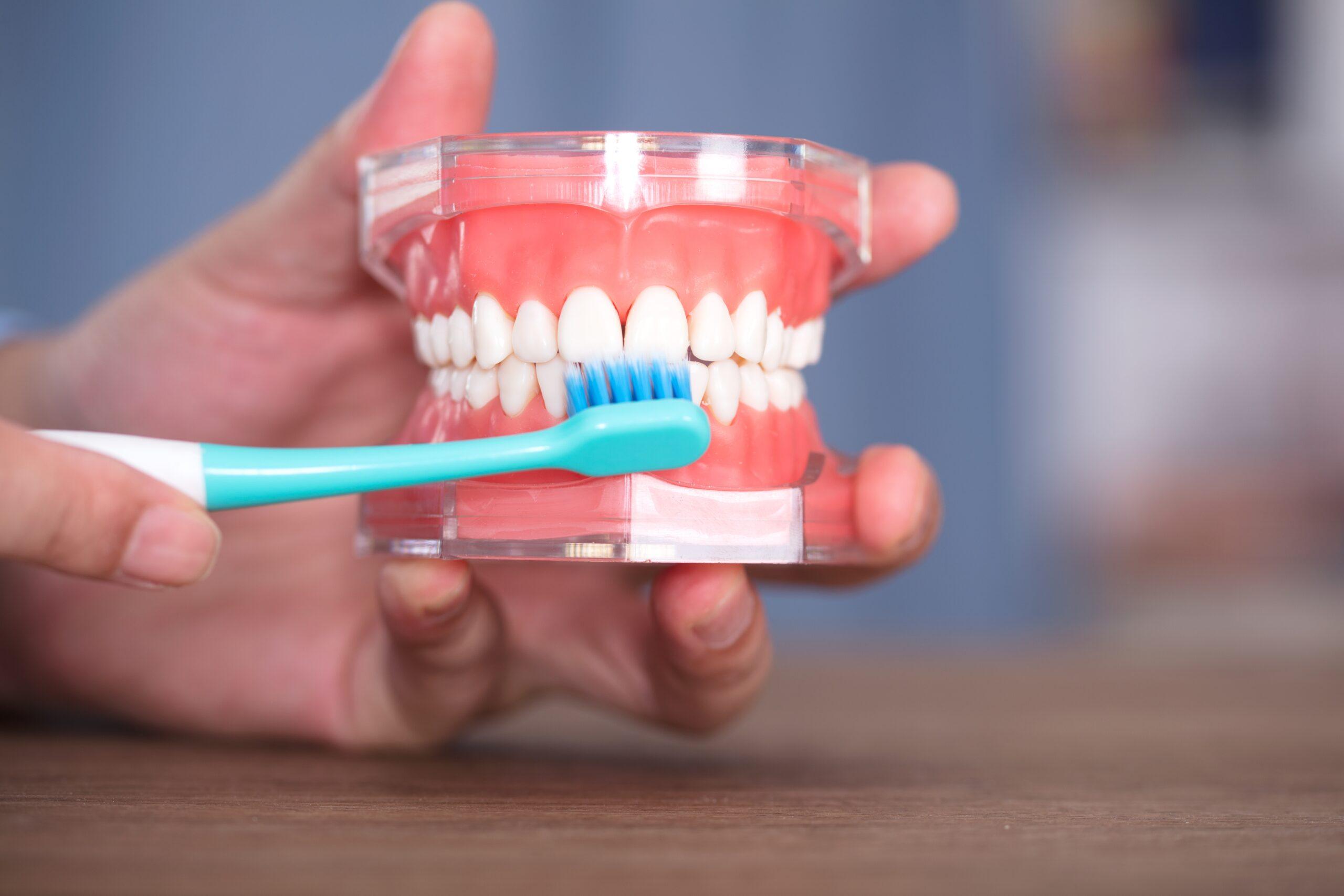 all-on-4術後清潔怎麼做＿泉玥牙醫