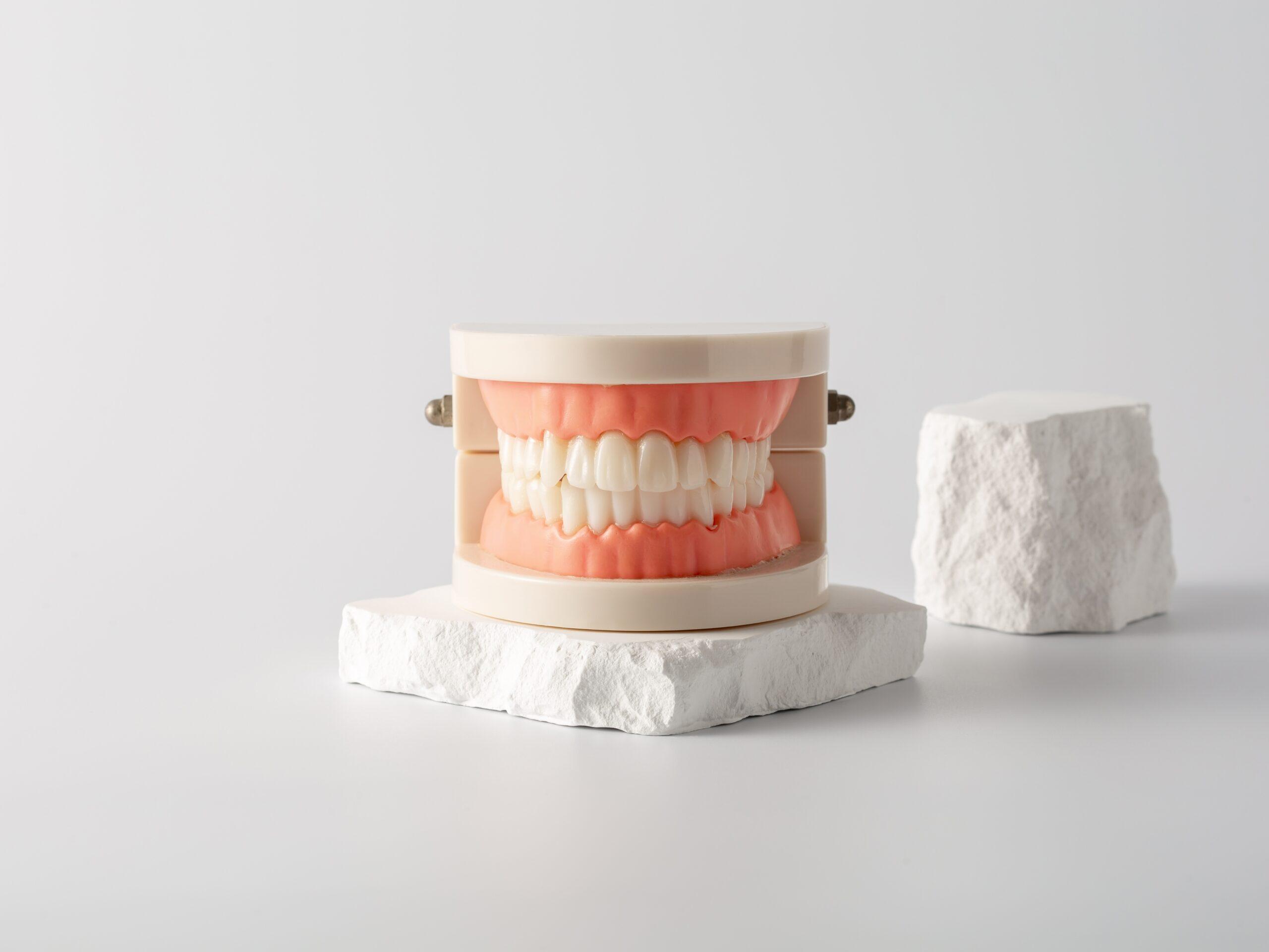 All-on-4 的正式牙怎麼選？材質差在哪？耐用度比較一次講清楚